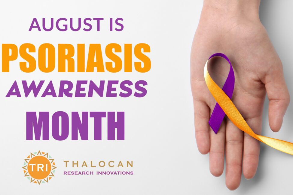 psoriasis
